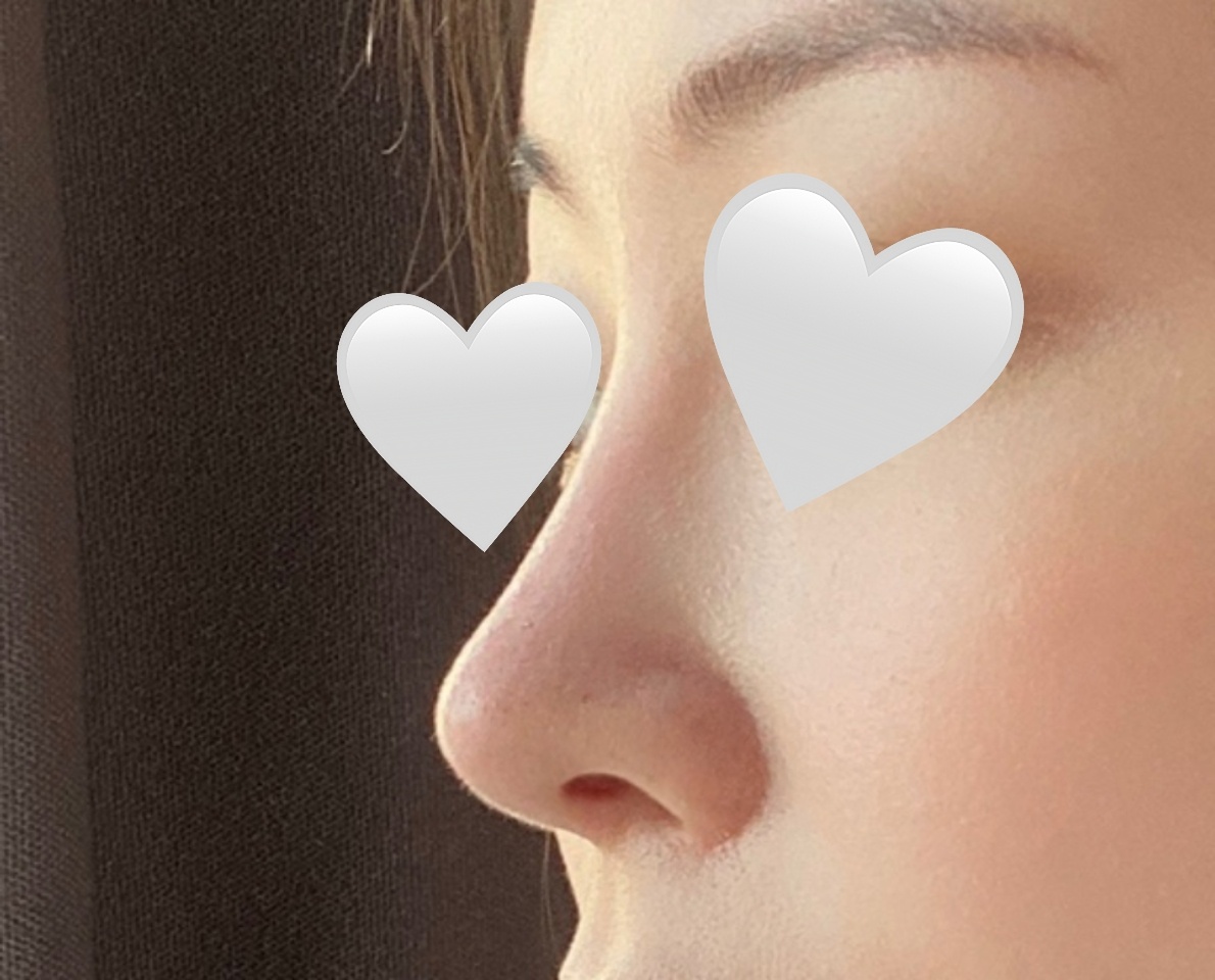 코6개월차 만족후기