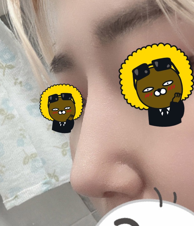 수술후_2_.jpg