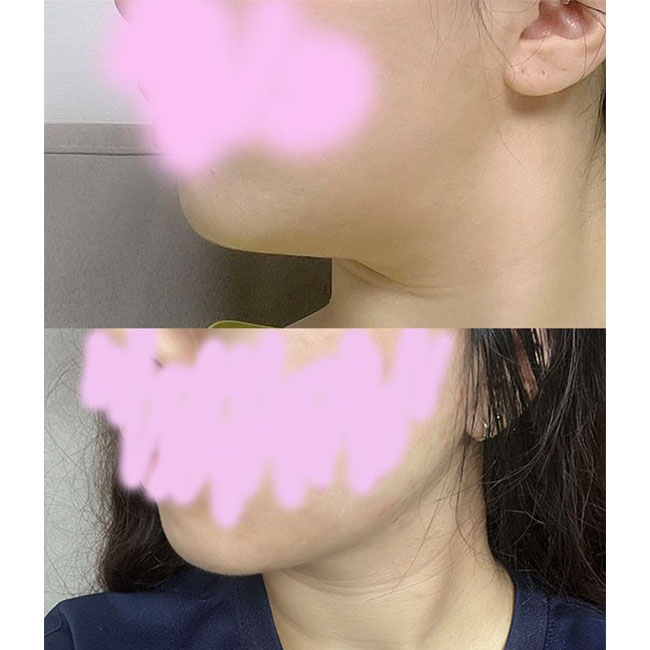 얼지흡 고민마시구 짱추천!!