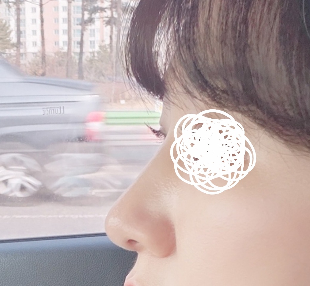 눈, 코 조화롭게 잘됐습니다^^