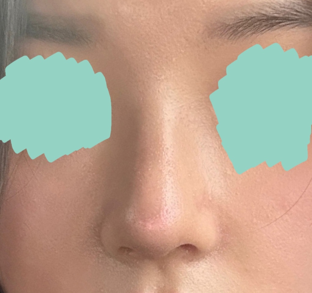 복코교정 제대로 됐슴다 ㅠ_ㅠb