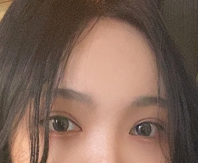 이마거상하고 인상 개선됐어요!