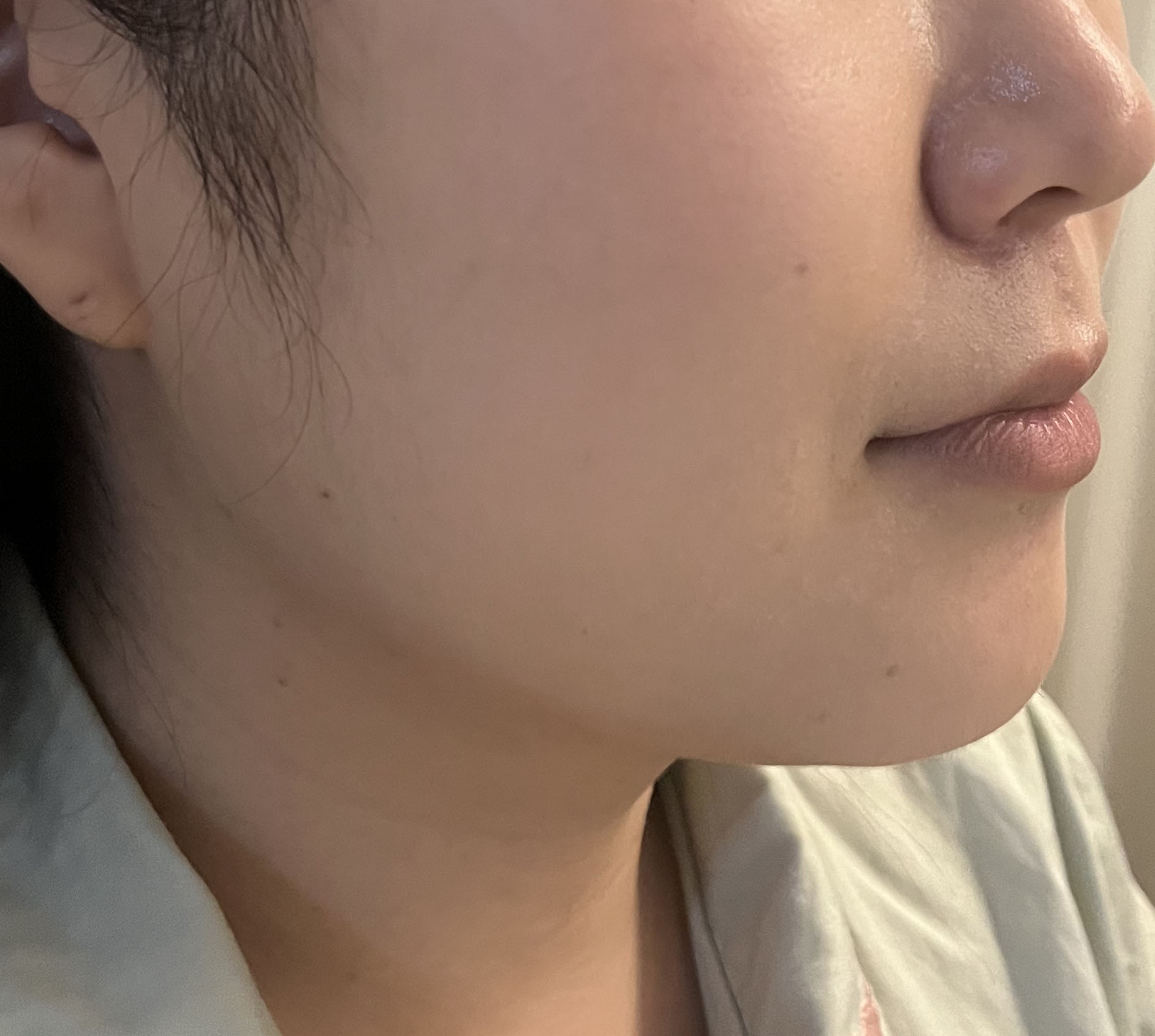 턱라인 매우 갸름갸름해졌어요