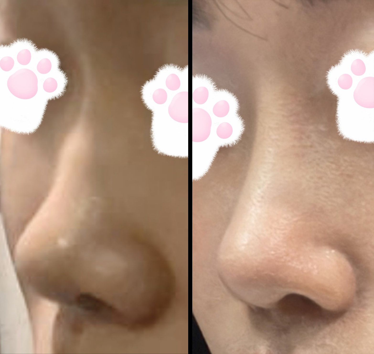 예쁜 직반라인으로 만들어주셨어요>.<