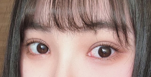 이마거상, 눈이랑 코 이중턱흡입까지 다 성공했어용