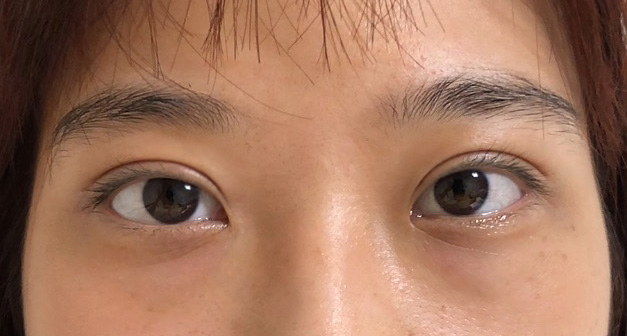 눈 라인 너무 예뻐여