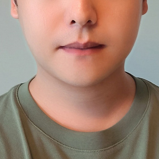 지흡 결과적으로 정말 만족