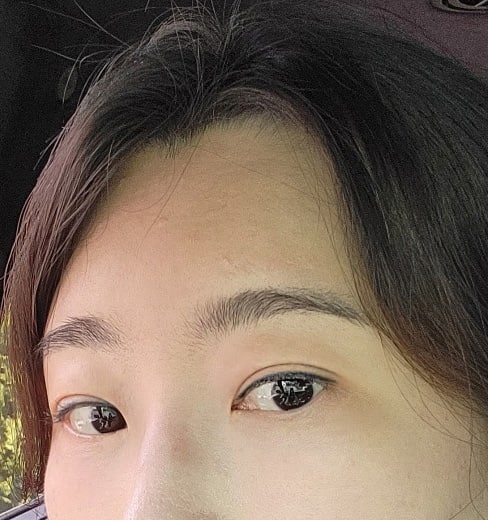 40대 이상인 분들 이마거상 꼭 하세요~