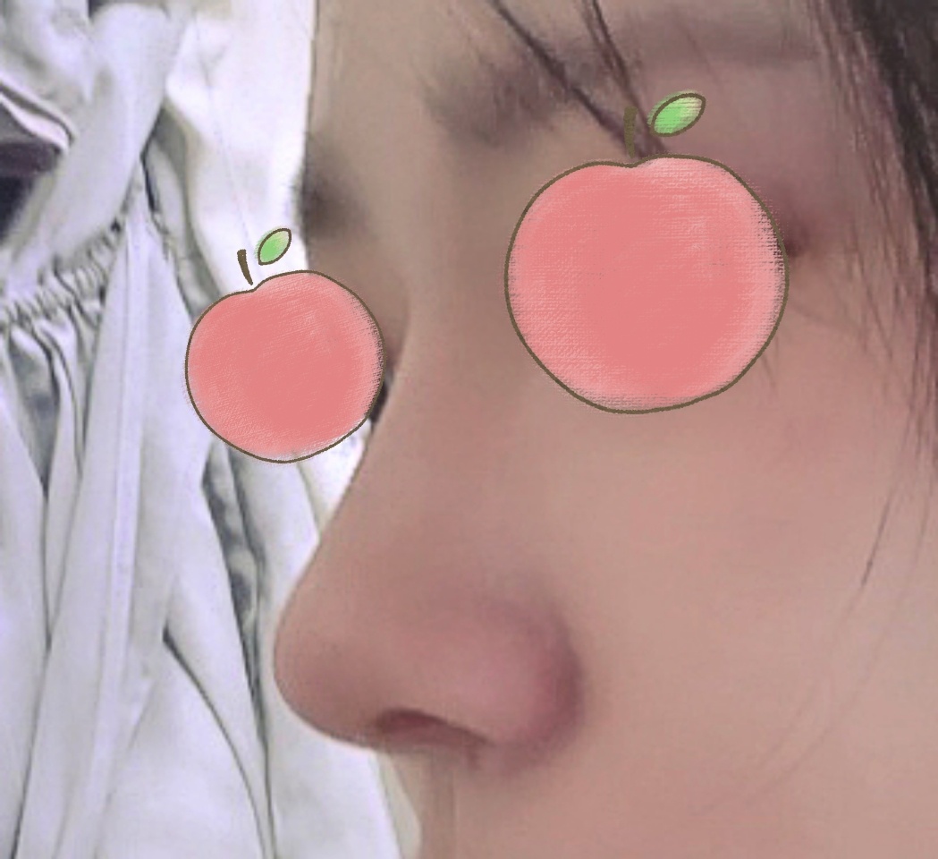 무에서 유를 창조해주셨어요 ㅠ_ㅠ원장님 실력최고!