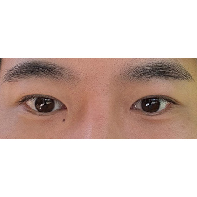 전보다 눈이 또렷해보입니다!