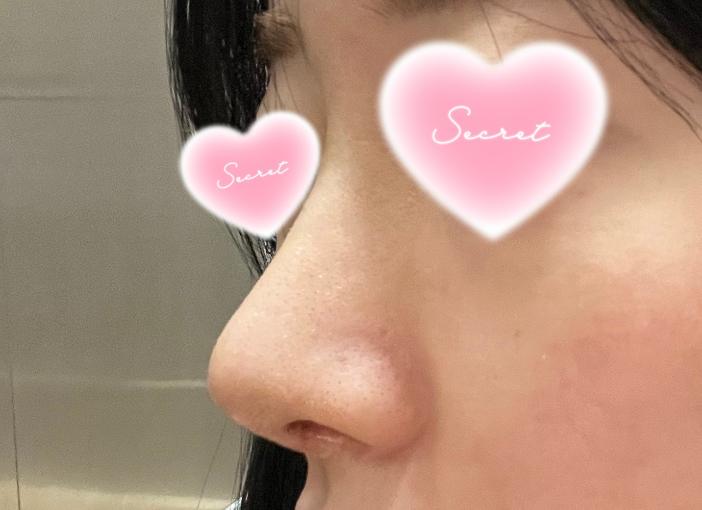 첫수술이었는데 넘만족이에요 강추드려용