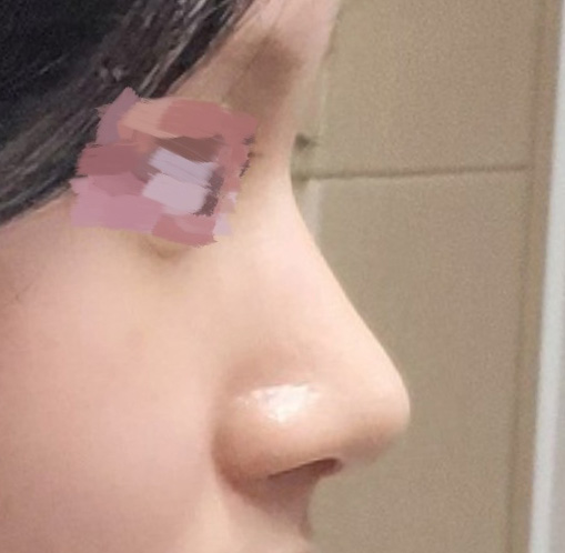 유영문원장님 정말 금손!! 코 넘예뻐용