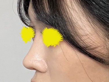 코콤플렉스 해결했어요