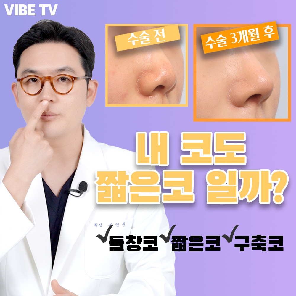 들창코/짧은코/구축코 코수술방법 정리!