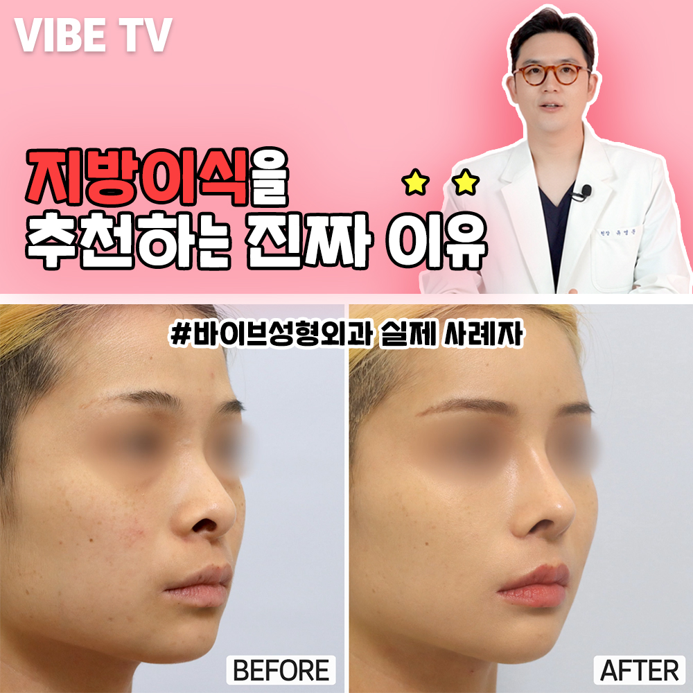 얼굴지방이식을 추천하는 진짜 이유는~?