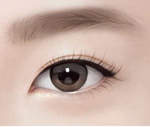 눈밑지방재배치 Step 04