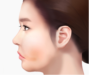 실리프팅 Step 01