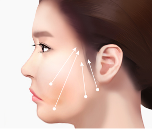 실리프팅 Step 02